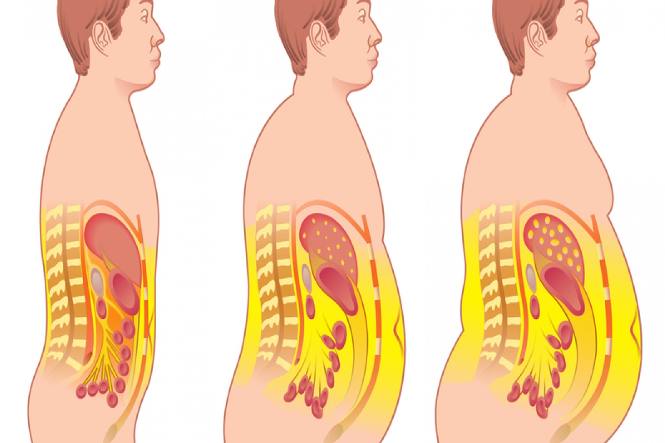 pohudenie_veszilarnyi_jir_karusel2