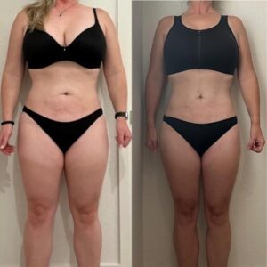 pohudenie_do_i_posle04